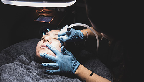 person receiving microdermabrasion treatment