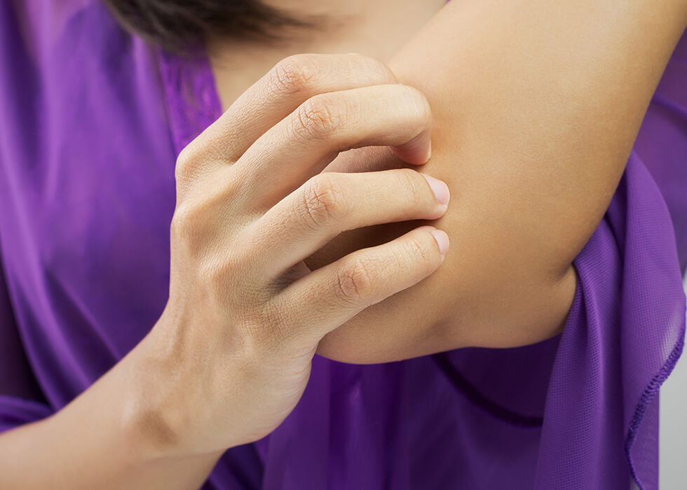 woman scratching elbow.