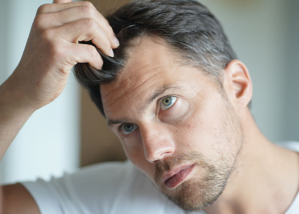 man looking at hair loss in mirror.